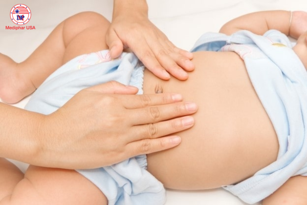 triệu chứng chướng bụng ở trẻ sơ sinh
